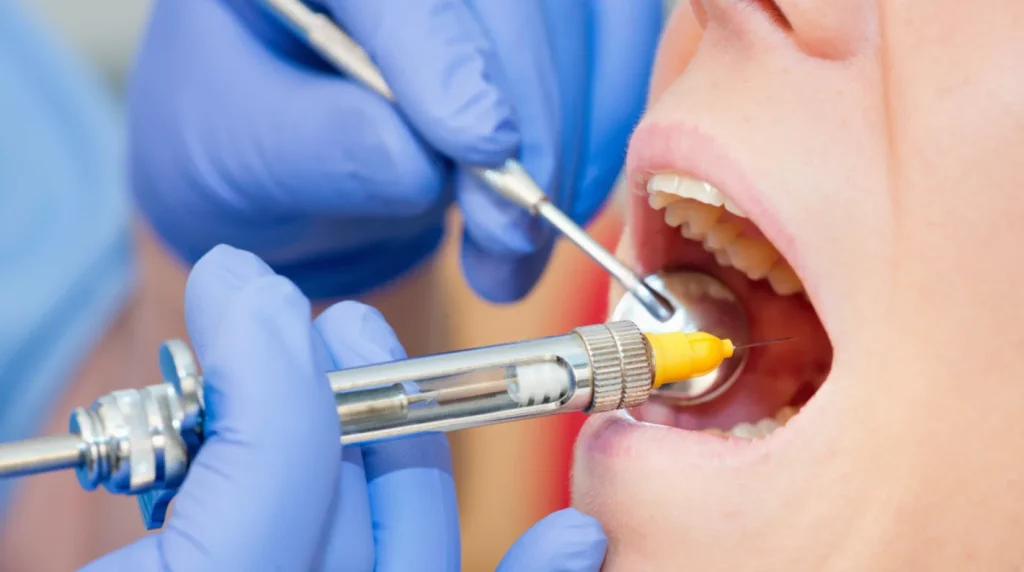anestesico-dental