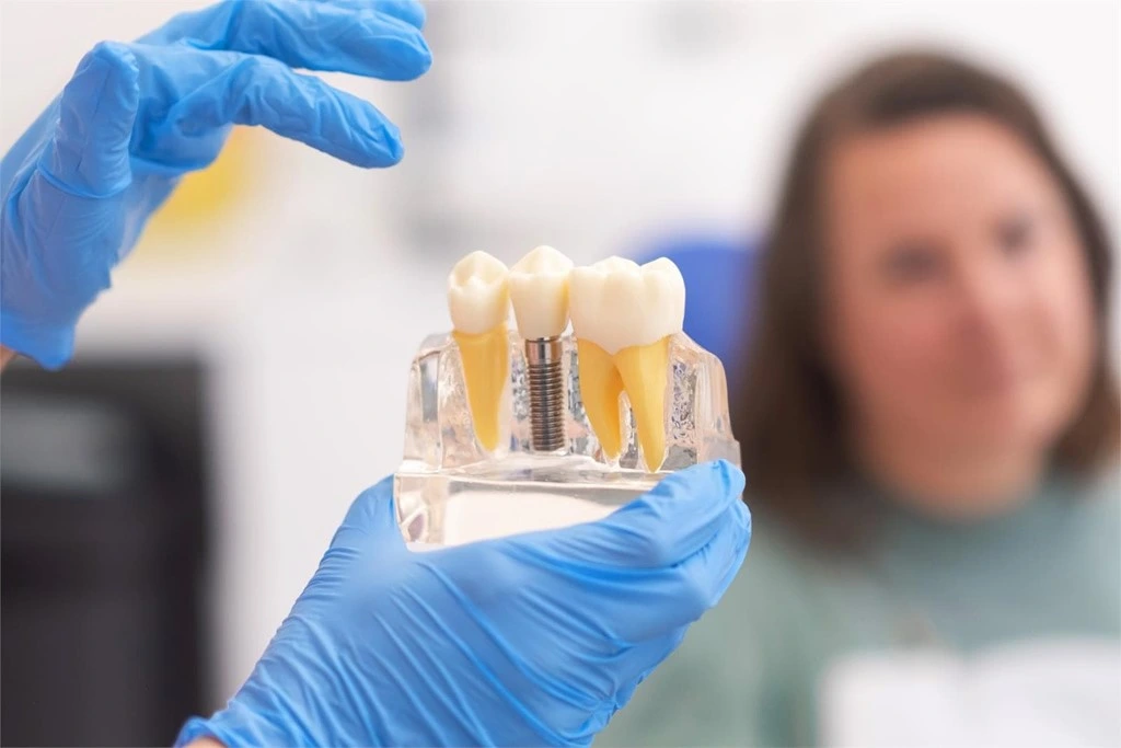 Cómo se ponen los implantes de carga inmediata