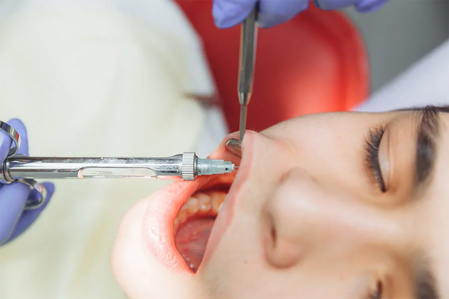 efectos-de-la-anestesia-dental