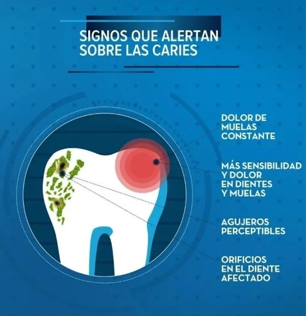 Prevención de las caries