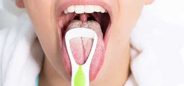 Causas del muguet oral