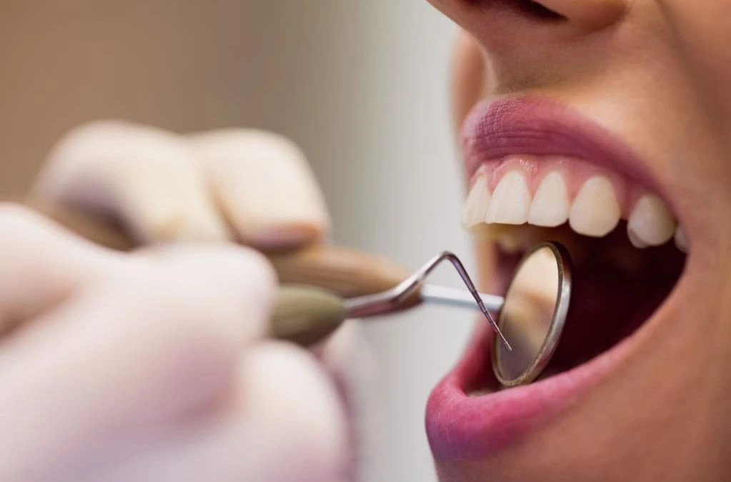 Por qué salen manchas en los dientes
