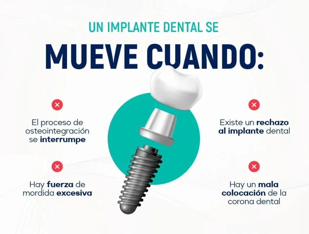 Por qué se mueve un implante dental