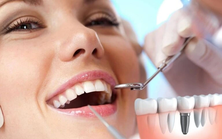 Problemas con los implantes dentales