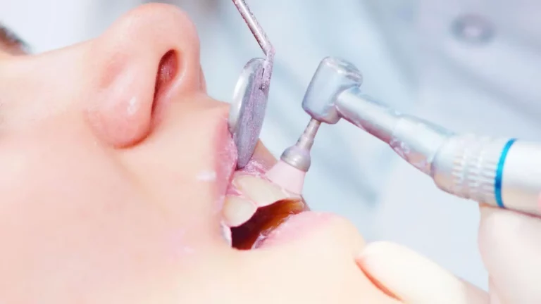 Cómo se hace una limpieza dental